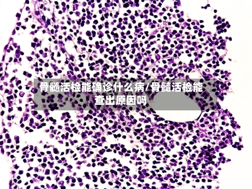骨髓活检能确诊什么病/骨髓活检能查出原因吗-第2张图片