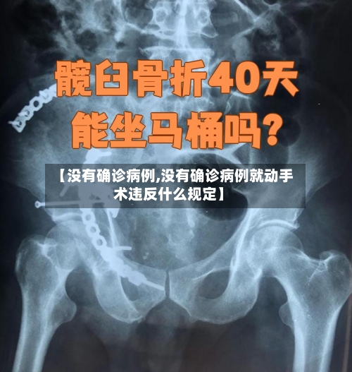 【没有确诊病例,没有确诊病例就动手术违反什么规定】