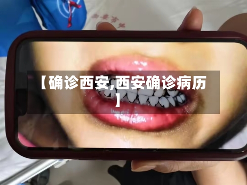 【确诊西安,西安确诊病历】-第2张图片
