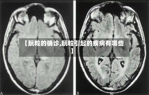 【朊粒的确诊,朊粒引起的疾病有哪些】-第2张图片