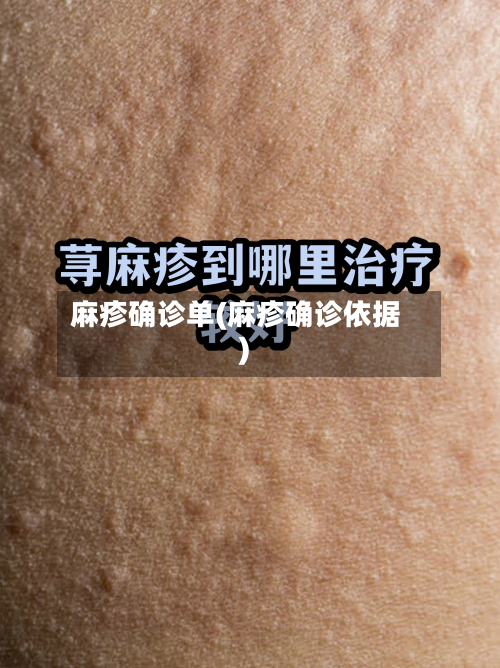 麻疹确诊单(麻疹确诊依据)-第2张图片