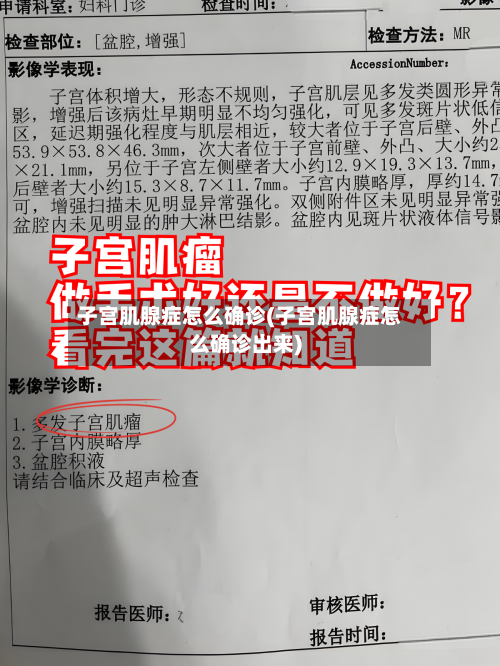 子宫肌腺症怎么确诊(子宫肌腺症怎么确诊出来)