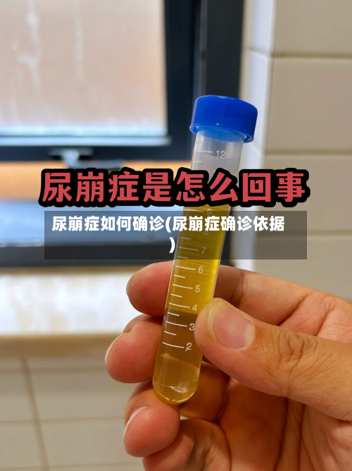 尿崩症如何确诊(尿崩症确诊依据)-第2张图片