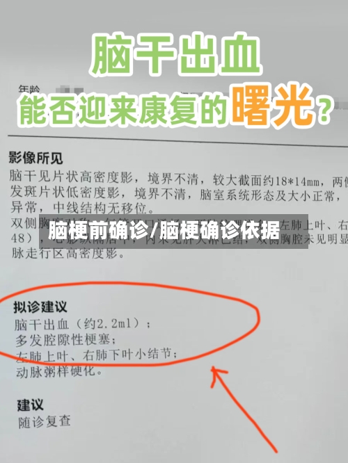 脑梗前确诊/脑梗确诊依据-第2张图片