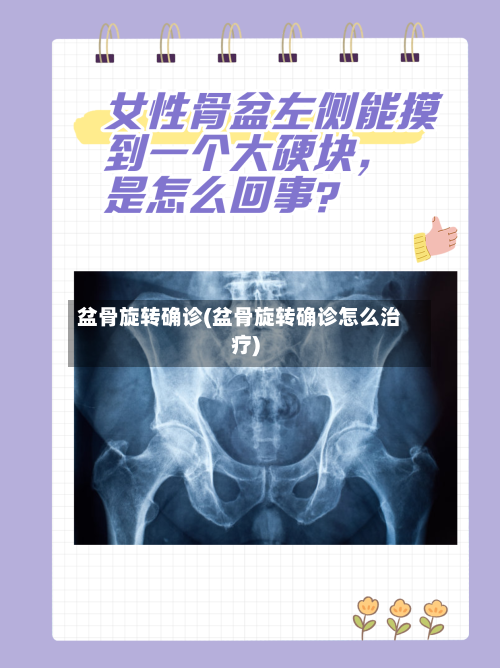 盆骨旋转确诊(盆骨旋转确诊怎么治疗)