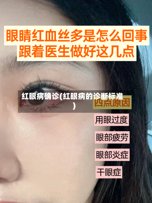 红眼病确诊(红眼病的诊断标准)