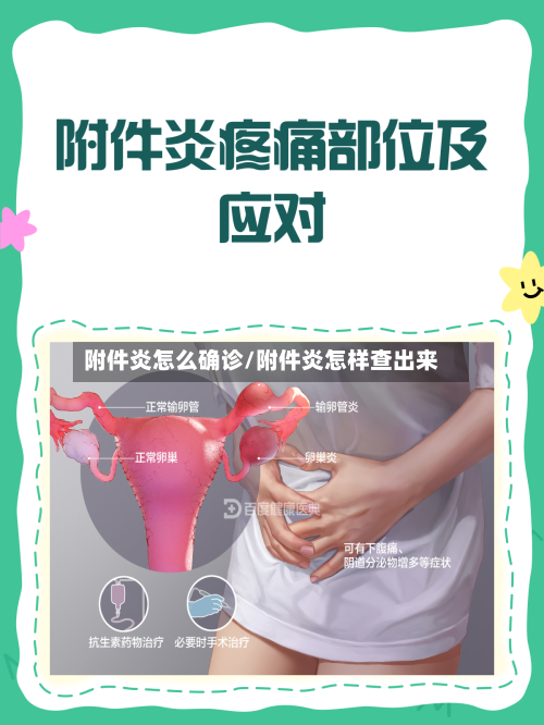 附件炎怎么确诊/附件炎怎样查出来