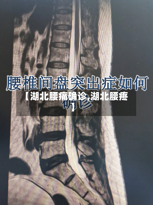 【湖北腰痛确诊,湖北腰疼】