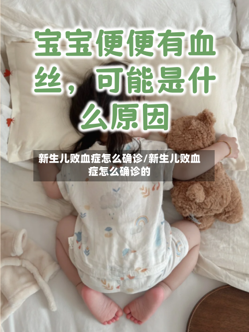 新生儿败血症怎么确诊/新生儿败血症怎么确诊的-第2张图片