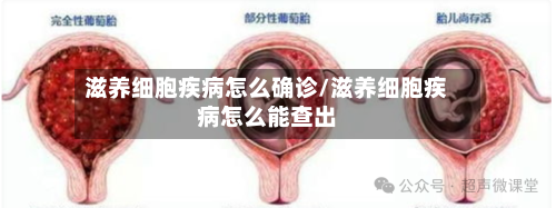 滋养细胞疾病怎么确诊/滋养细胞疾病怎么能查出-第2张图片