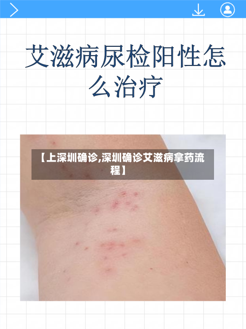 【上深圳确诊,深圳确诊艾滋病拿药流程】-第3张图片
