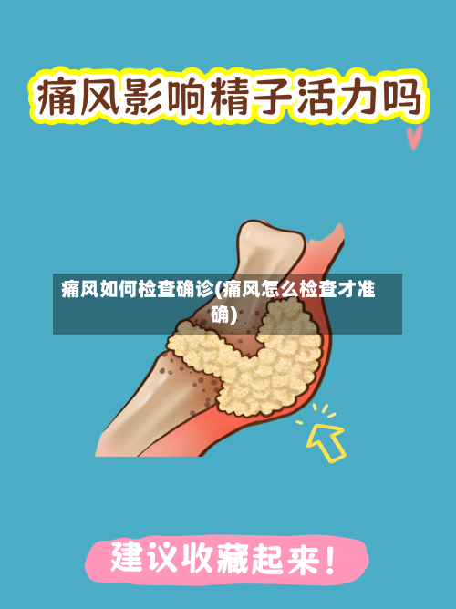 痛风如何检查确诊(痛风怎么检查才准确)