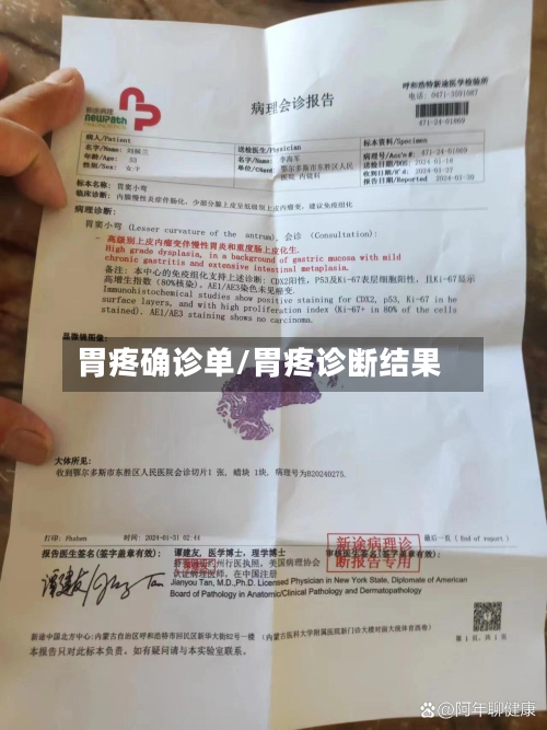 胃疼确诊单/胃疼诊断结果