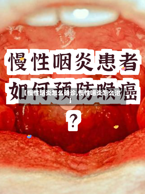 【慢性咽炎怎么确诊,慢性咽炎怎么治】