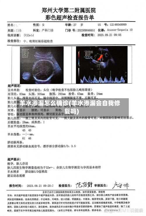 羊水渗漏怎么确诊(羊水渗漏会自我修复吗)-第2张图片