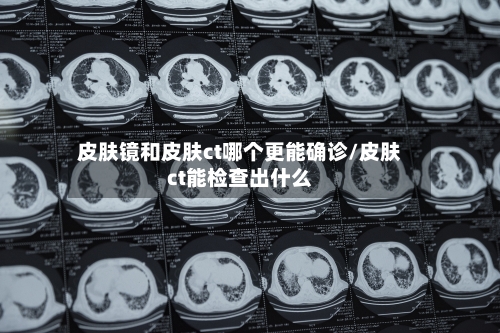 皮肤镜和皮肤ct哪个更能确诊/皮肤ct能检查出什么