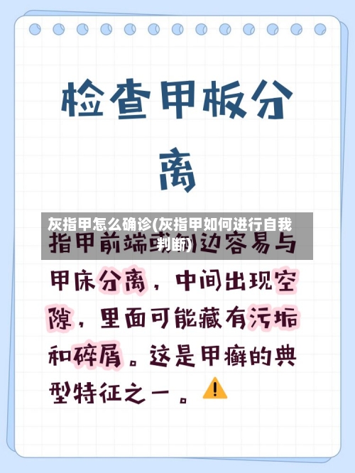 灰指甲怎么确诊(灰指甲如何进行自我判断)