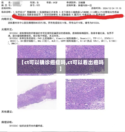 【ct可以确诊癌症吗,ct可以看出癌吗】