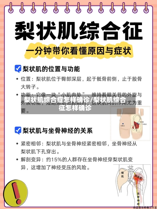 梨状肌综合症怎样确诊/梨状肌综合征怎样确诊