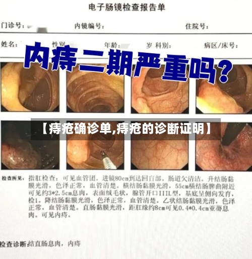 【痔疮确诊单,痔疮的诊断证明】-第2张图片