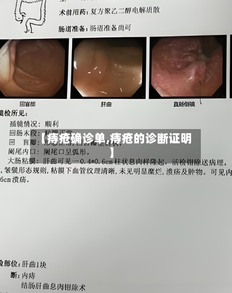 【痔疮确诊单,痔疮的诊断证明】