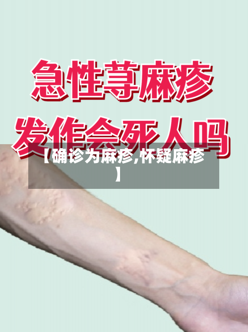 【确诊为麻疹,怀疑麻疹】