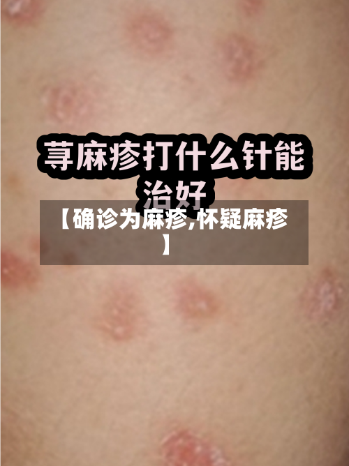 【确诊为麻疹,怀疑麻疹】-第2张图片