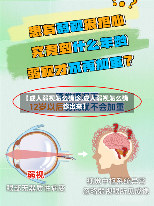【成人弱视怎么确诊,成人弱视怎么确诊出来】