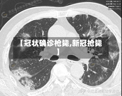 【冠状确诊枪毙,新冠抢毙】
