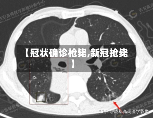 【冠状确诊枪毙,新冠抢毙】-第2张图片