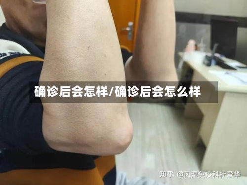 确诊后会怎样/确诊后会怎么样