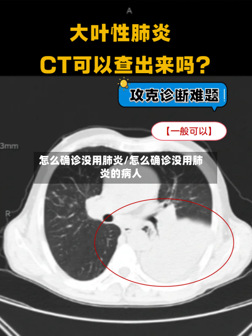 怎么确诊没用肺炎/怎么确诊没用肺炎的病人