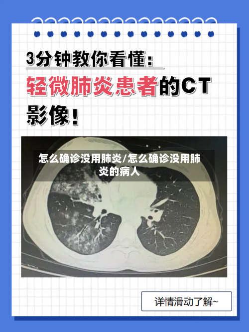 怎么确诊没用肺炎/怎么确诊没用肺炎的病人-第2张图片