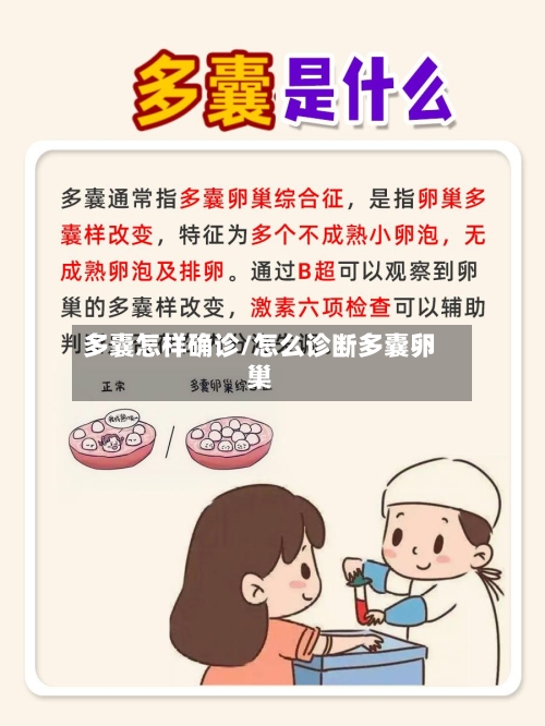 多囊怎样确诊/怎么诊断多囊卵巢-第2张图片