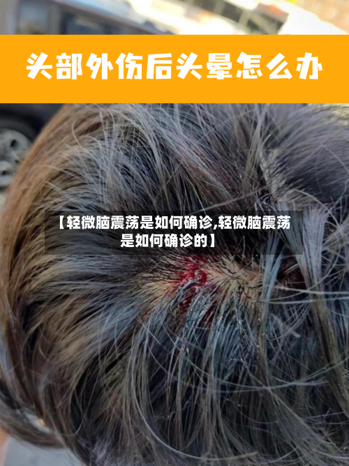 【轻微脑震荡是如何确诊,轻微脑震荡是如何确诊的】-第3张图片