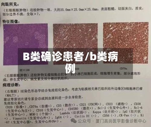 B类确诊患者/b类病例