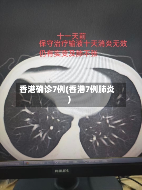 香港确诊7例(香港7例肺炎)-第2张图片
