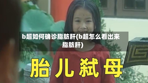 b超如何确诊脂肪肝(b超怎么看出来脂肪肝)-第3张图片