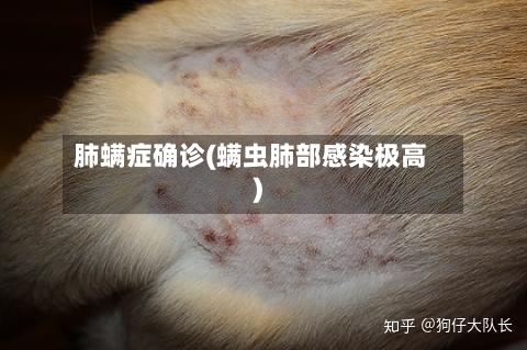 肺螨症确诊(螨虫肺部感染极高)