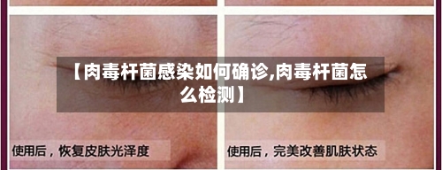 【肉毒杆菌感染如何确诊,肉毒杆菌怎么检测】