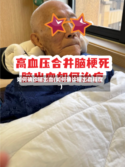 如何确诊脑出血(如何确诊脑出血程度)-第2张图片