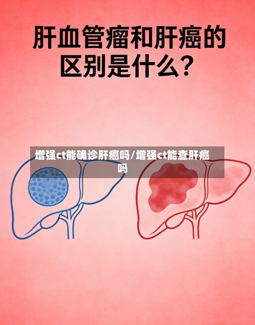 增强ct能确诊肝癌吗/增强ct能查肝癌吗