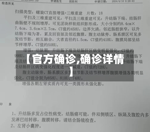 【官方确诊,确诊详情】
