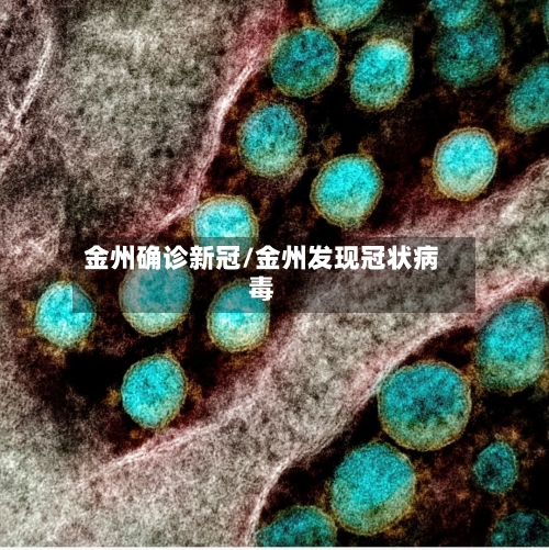 金州确诊新冠/金州发现冠状病毒