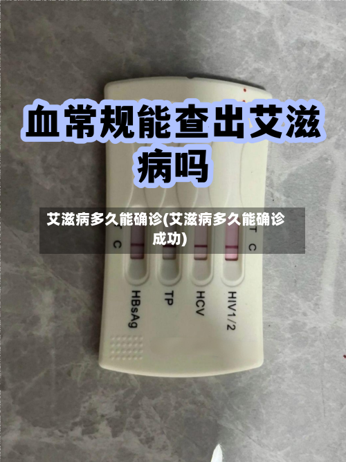艾滋病多久能确诊(艾滋病多久能确诊成功)