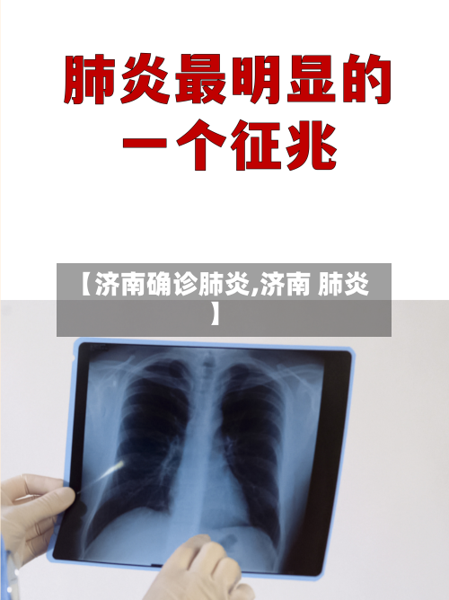 【济南确诊肺炎,济南 肺炎】-第3张图片