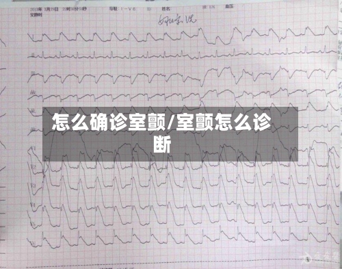 怎么确诊室颤/室颤怎么诊断