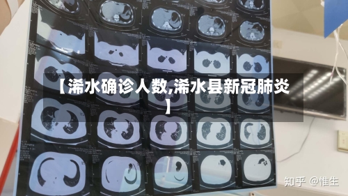 【浠水确诊人数,浠水县新冠肺炎】-第3张图片