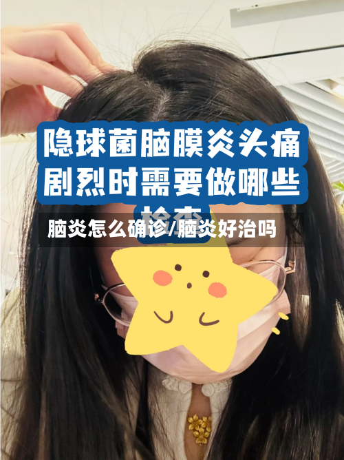 脑炎怎么确诊/脑炎好治吗-第2张图片