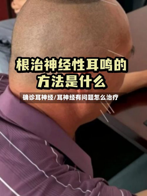 确诊耳神经/耳神经有问题怎么治疗-第2张图片